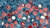 ARCHIVO - Imagen sin fecha, proporcionada por el Instituto Nacional de Enfermedades Alérgicas e Infecciosas (NIAID) muestra una micrografía electrónica coloreada de partículas de viruela símica halladas dentro de una célula infectada en Fort Detrick, Maryland.
