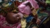 FILE - A Papuan child suffering from malnutrition lies in a hospital bed for treatment in Agats, the capital of Asmat district in Indonesia's easternmost Papua province, Jan. 26, 2018.