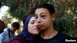 Tariq Khdeir, palestino-estadounidense de 15 años, fue golpeado por policías israelíes.