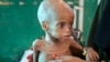 Risk of Death from Starvation Grows in Africa